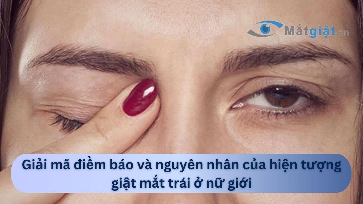 giật mắt trái ở nữ