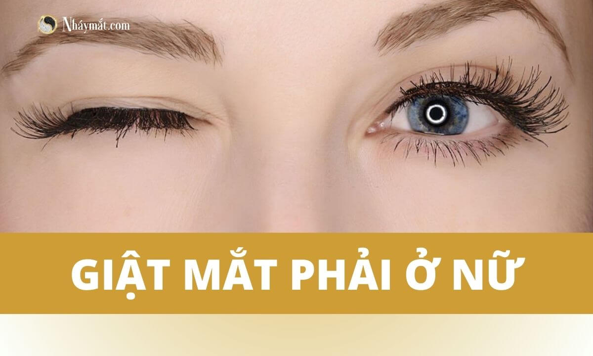 Giật mắt phải ở nữ