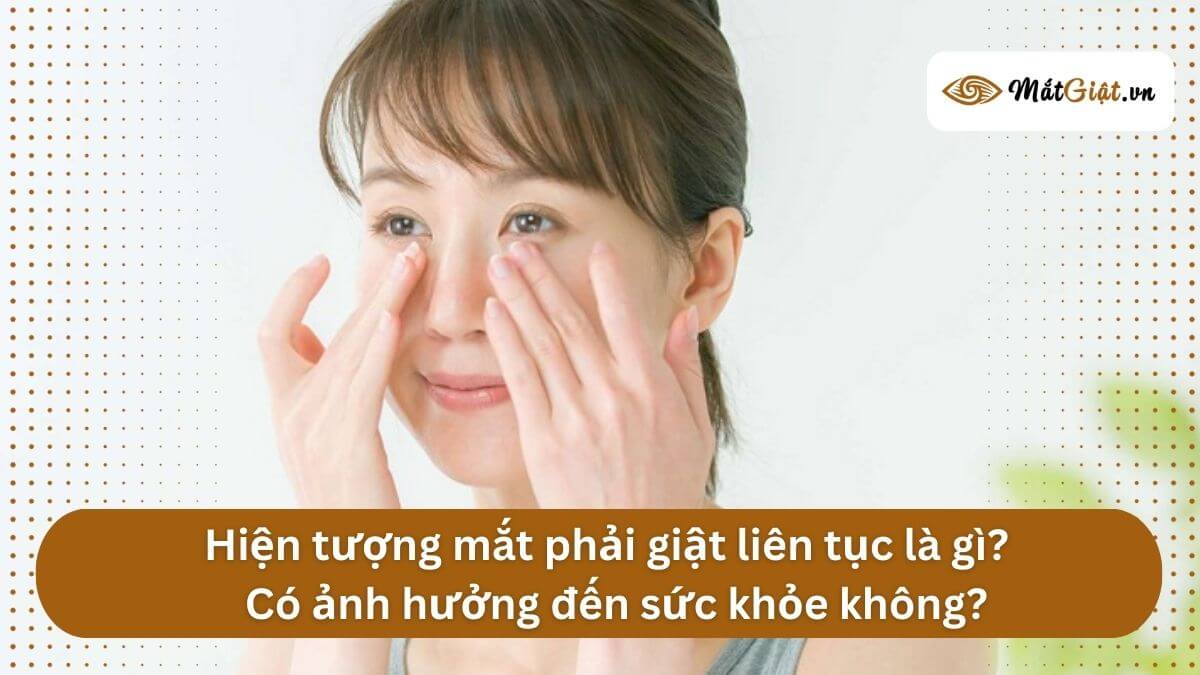 Hiện tượng giật mắt phải liên tục